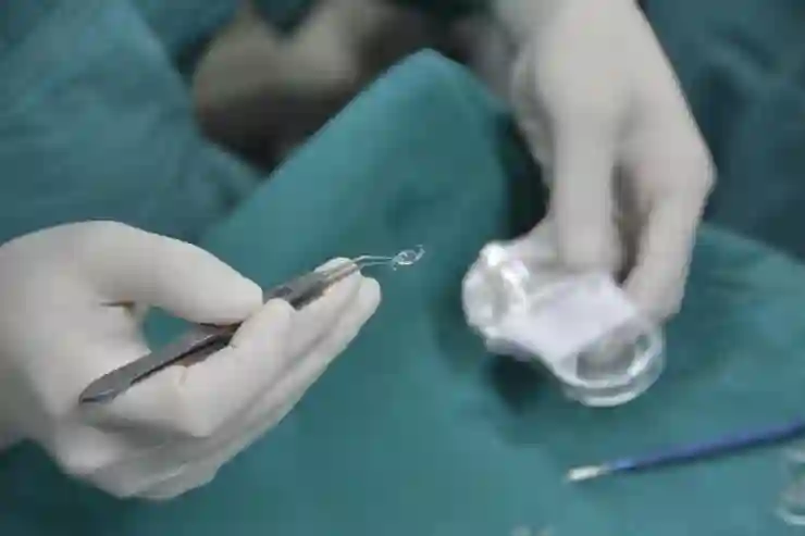 달서구 용산동에서 저렴하게 임플란트 받는 법과 추천 치과병원 탐방